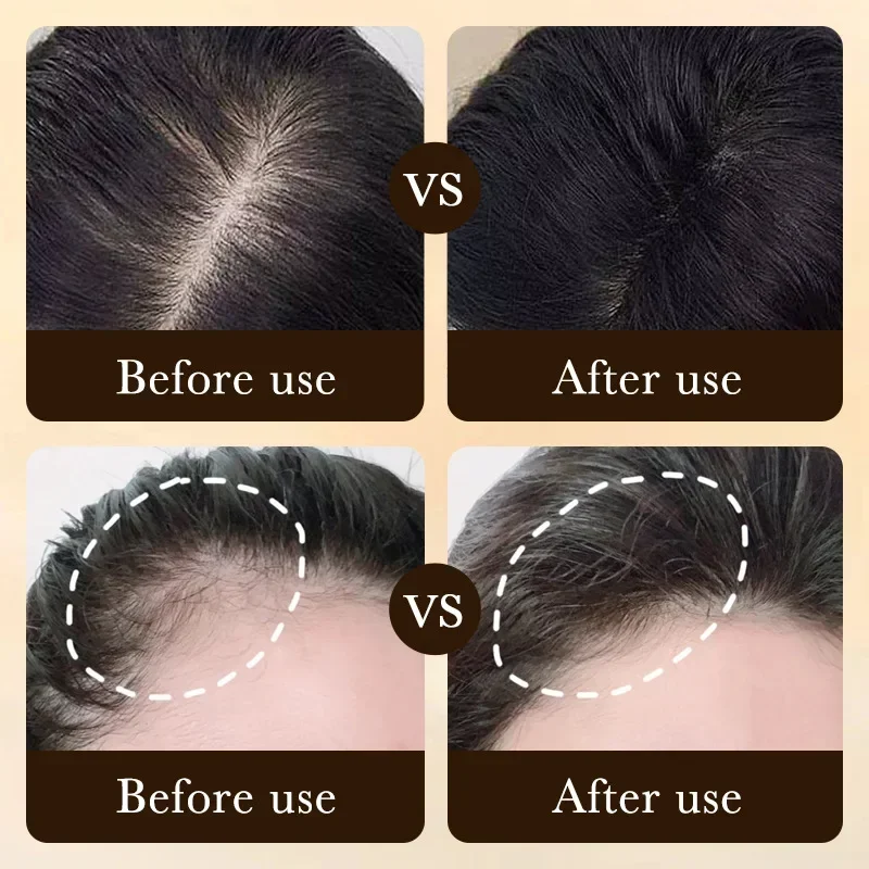 Olio per Crescita Rapida dei C - Hair Care Lotion recensione e prezzo